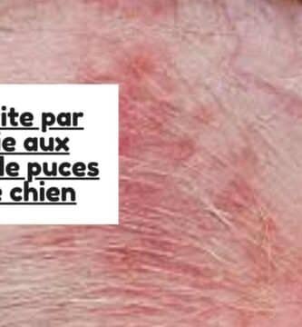 Dermatite par allergie aux piqûres de puces