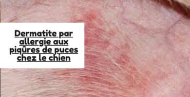 Dermatite par allergie aux piqûres de puces